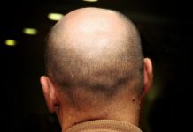 KEL BAŞA ARAP SAÇI