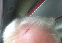 SAKSIYA DİKKAT, SAĞA DÖNÜLMEZ